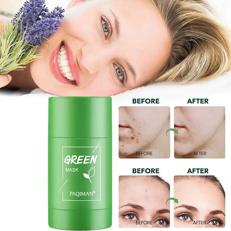 Máscara de Chá Verde de Limpeza Sólida - Remove Acne, Cravo e Hidrata sua Pele